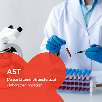 Aspartátaminotransferáza (AST) - laboratorní vyšetření (Laboratorní testy jater a slinivky)