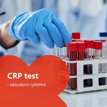 C - reaktivní protein (CRP) - laboratorní vyšetření (Testy imunity a mikrobiomu)