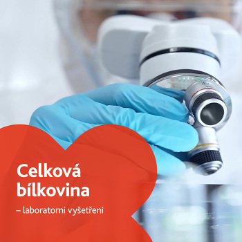 Celková bílkovina - laboratorní vyšetření (Laboratorní testy jater a slinivky)