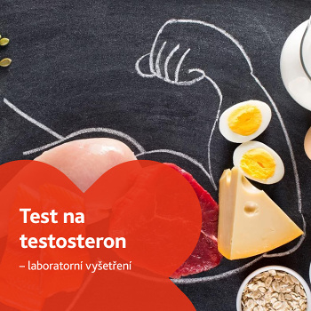 Celkový testosteron - laboratorní vyšetření (Vyšetření testosteronu a mužských hormonů)