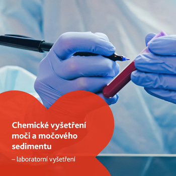 Chemické vyšetření moči a močového sedimentu - laboratorní vyšetření (Vyšetření ledvin, močových cest a prostaty)