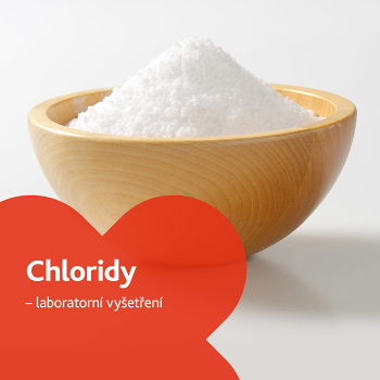 Chloridy - laboratorní vyšetření (Stanovení hladiny vitamínů a minerálů)