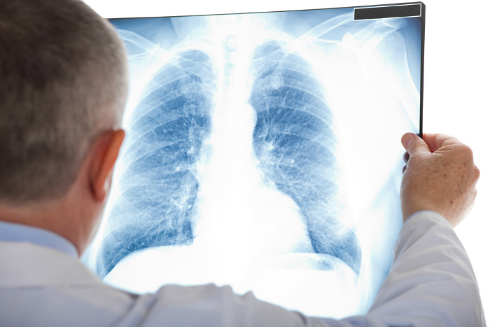 Co je a jak se léčí zápal plic (pneumonie)