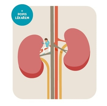 MEDILA Funkce ledvin (Ostatní testy)