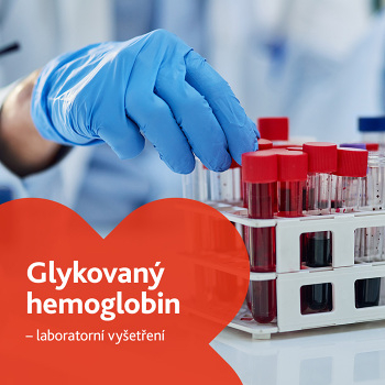 Glykovaný hemoglobin (HbA1c) - laboratorní vyšetření (Laboratorní vyšetření diabetu, glukózy)