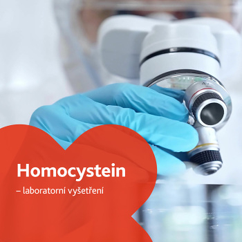 Homocystein - laboratorní vyšetření (Vyšetření anémie a krevní skupiny)