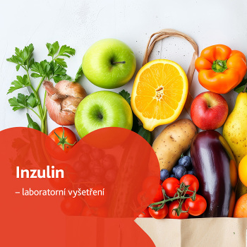Inzulin - laboratorní vyšetření (Laboratorní vyšetření diabetu, glukózy)