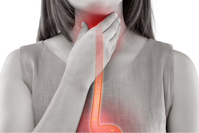 Jícnový reflux - příznaky, léčba, strava a režimová opatření