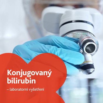 Konjugovaný bilirubin - laboratorní vyšetření (Laboratorní testy jater a slinivky)
