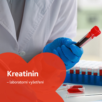Kreatinin - laboratorní vyšetření (Vyšetření ledvin, močových cest a prostaty)