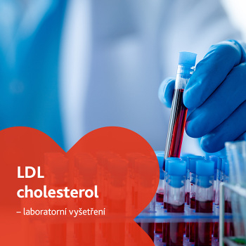 LDL cholesterol - laboratorní vyšetření (Testy srdce, cév a cholesterolu)