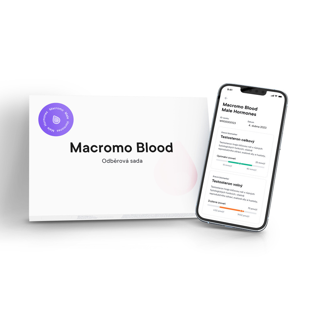 E-shop MACROMO krevní test Mužské hormony