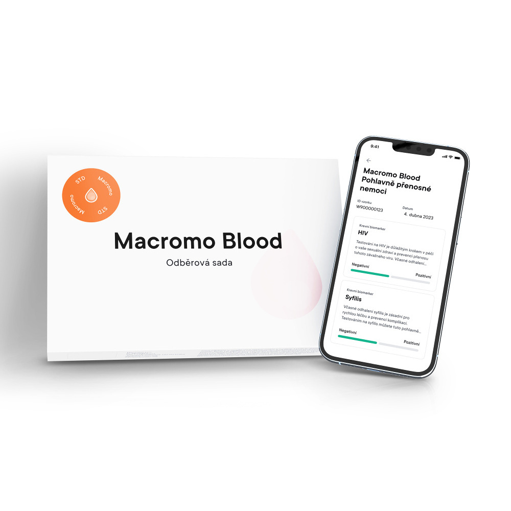 E-shop MACROMO krevní test Pohlavně přenosné nemoci