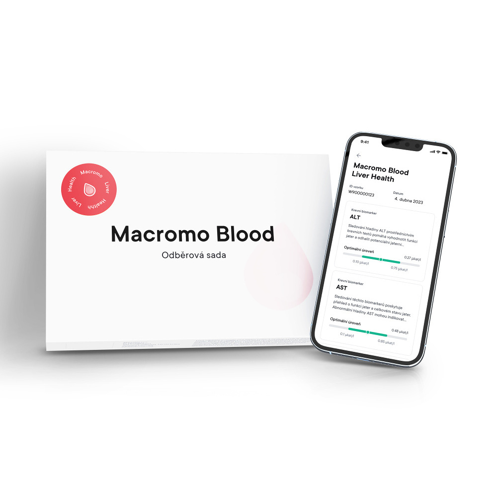 Levně MACROMO krevní test Zdravá játra
