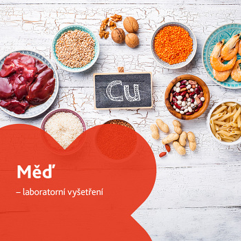 Měď - laboratorní vyšetření (Stanovení hladiny vitamínů a minerálů)