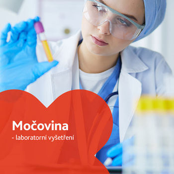 Močovina (Urea) - laboratorní vyšetření (Vyšetření ledvin, močových cest a prostaty)