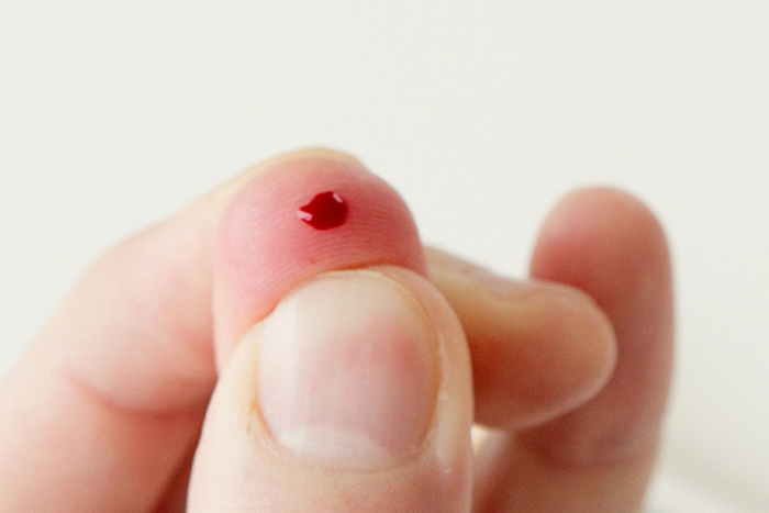 Na co jsou CRP testy a kdy mohou pomoci