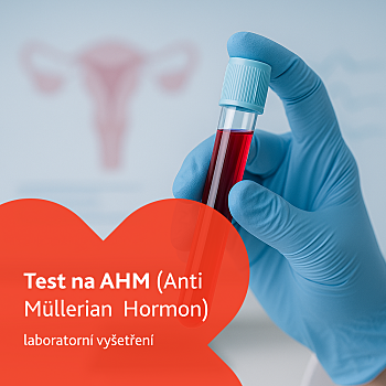 Test na AHM (Anti Müllerian Hormon) laboratorní vyšetření (Komplexní laboratorní vyšetření)