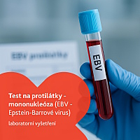 Test na protilátky - mononukleóza laboratorní vyšetření