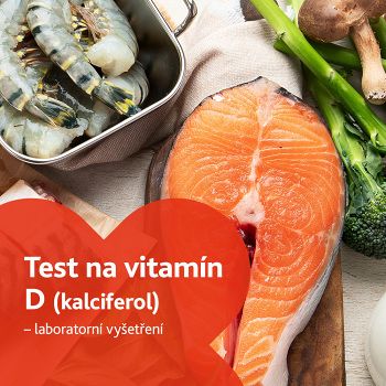 Test na vitamín D (kalciferol) - laboratorní vyšetření (Stanovení hladiny vitamínů a minerálů)