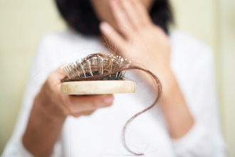 Trápení s vlasy - II. část (Vyšetření v Centru zdravých vlasů)