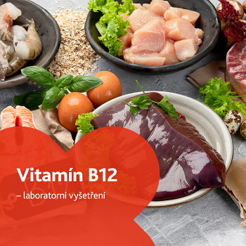 Vitamín B12 - laboratorní vyšetření (Stanovení hladiny vitamínů a minerálů)