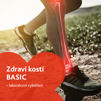 Zdraví kostí BASIC - laboratorní vyšetření (Vyšetření kostí a kloubů)
